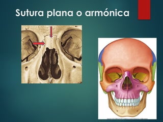 Sutura plana o armónica
 