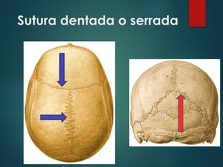 Sutura dentada o serrada
 