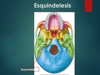 Esquindelesis
Esquindelesis
 