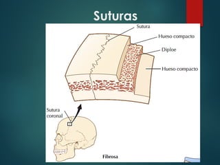 Suturas
 