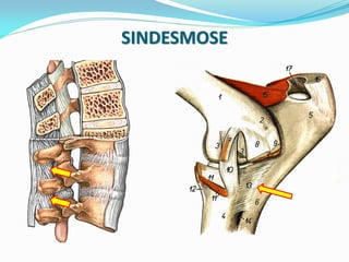 SINDESMOSE
 