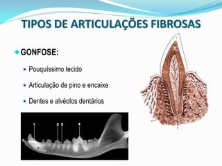 TIPOS DE ARTICULAÇÕES FIBROSAS

GONFOSE:

  Pouquíssimo tecido

  Articulação de pino e encaixe

  Dentes e alvéolos dentários
 