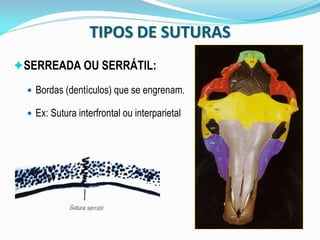 TIPOS DE SUTURAS
SERREADA OU SERRÁTIL:

   Bordas (dentículos) que se engrenam.

   Ex: Sutura interfrontal ou interparietal
 