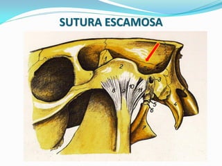 SUTURA ESCAMOSA
 