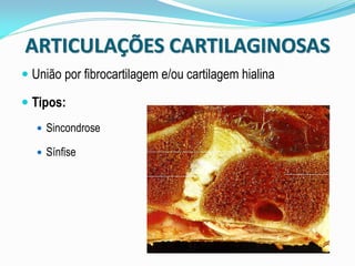 ARTICULAÇÕES CARTILAGINOSAS
 União por fibrocartilagem e/ou cartilagem hialina

 Tipos:
    Sincondrose

    Sínfise
 
