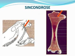 SINCONDROSE
 