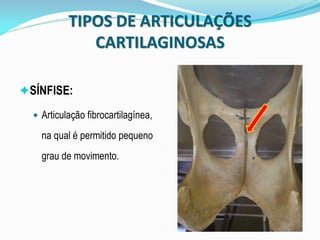 TIPOS DE ARTICULAÇÕES
              CARTILAGINOSAS

SÍNFISE:

   Articulação fibrocartilagínea,

    na qual é permitido pequeno
    grau de movimento.
 