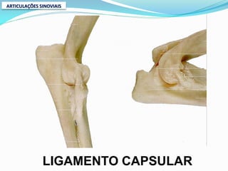 ARTICULAÇÕES SINOVIAIS




              LIGAMENTO CAPSULAR
 