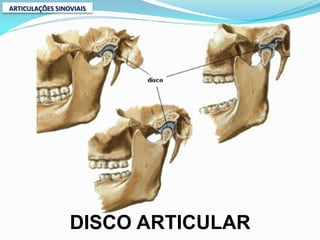 ARTICULAÇÕES SINOVIAIS




                 DISCO ARTICULAR
 