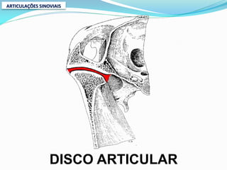 ARTICULAÇÕES SINOVIAIS




                 DISCO ARTICULAR
 