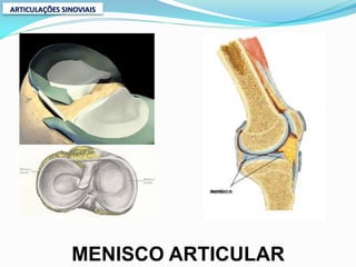 ARTICULAÇÕES SINOVIAIS




               MENISCO ARTICULAR
 