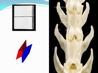 ARTICULAÇÃO
   PLANA
 