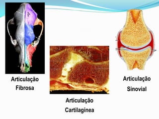Articulação                  Articulação
 Fibrosa                      Sinovial
              Articulação
              Cartilagínea
 