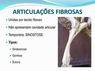 ARTICULAÇÕES FIBROSAS
 Unidas por tecido fibroso

 Não apresentam cavidade articular

 Temporária: SINOSTOSE

 Tipos:
    Sindesmose

    Gonfose

    Sutura
 