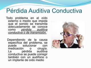 Pérdida Auditiva Conductiva
Todo problema en el oído
externo o medio que impida
que el sonido se transmita
adecuadamente se conoce
como pérdida auditiva
conductiva o de transmisión.
Dependiendo de la causa
específica del problema, se
puede solucionar con
medicación o cirugía.
La pérdida auditiva
conductiva se puede corregir
también con un audífono o
un implante de oído medio
 