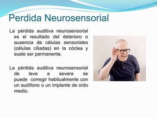 Perdida Neurosensorial
La pérdida auditiva neurosensorial
es el resultado del deterioro o
ausencia de células sensoriales
(células ciliadas) en la cóclea y
suele ser permanente.
La pérdida auditiva neurosensorial
de leve a severa se
puede corregir habitualmente con
un audífono o un implante de oído
medio.
 