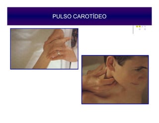 PULSO CAROTÍDEO
Epstein O, 1998
 