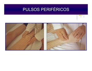 PULSOS PERIFÉRICOS
Epstein O, 1998
 
