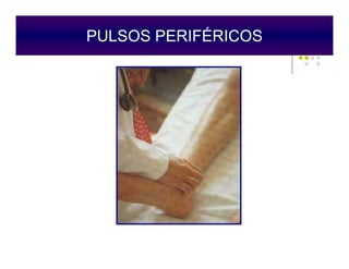 PULSOS PERIFÉRICOS
Epstein O, 1998
 