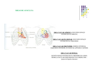 ÁREAS DE AUSCULTA
ÁREA VALVAR AÓRTICA: SEGUNDO ESPAÇO
INTERCOSTAL DIREITO
ÁREA VALVAR PULMONAR: SEGUNDO ESPAÇO
INTERCOSTAL ESQUERDO
ÁREA VALVAR TRICÚSPIDE: BORDA ESTERNAL
ESQUERDA INFERIOR, OU BASE DO APÊNDICE XIFÓIDE
ÁREA VALVAR MITRAL:
QUINTO ESPAÇO INTERCOSTAL PRÓXIMO DA LINHA
HEMICLAVICULAR ESQUERDA(ICTUS CORDIS, PIM –
(ponto de impulso máximo)
 