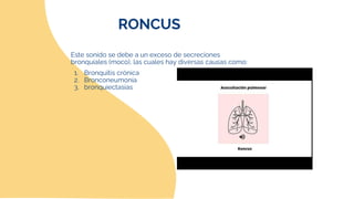 RONCUS
Este sonido se debe a un exceso de secreciones
bronquiales (moco), las cuales hay diversas causas como:
1. Bronquit...