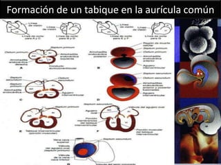 Formación de un tabique en la aurícula común
 