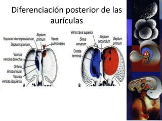 Diferenciación posterior de las
aurículas
 