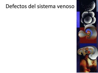 Defectos del sistema venoso
 