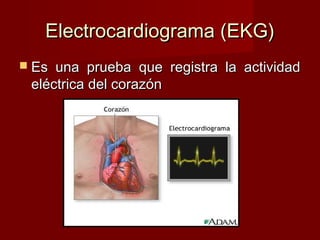 Electrocardiograma (EKG) Es una prueba que registra la actividad eléctrica del corazón  