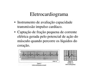 Eletrocardiograma
• Instrumento de avaliação capacidade
transmissão impulso cardíaco.
• Captação de fração pequena de corrente
elétrica gerada pelo potencial de ação doelétrica gerada pelo potencial de ação do
músculo quando percorre os líquidos do
coração.
 