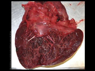 http://shutterbug.ucsc.edu/albums/album204/heart_anatomy_left_001.jpg
 
