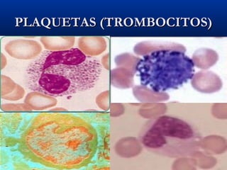 PLAQUETAS (TROMBOCITOS)PLAQUETAS (TROMBOCITOS)
 