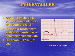 INTERVALO PR
• Desde el inicio de la
onda P, hasta el inicio
del complejo QRS
• Tiempo q tarda entre
activación auricular y
activación ventricular.
• Duración 0,12 a 0,21
seg.
Clínica DOVER, 2002
 