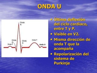 ONDA U
• Última deflexión
del ciclo cardiaco,
entre T y P.
• Visible en V2.
• Misma dirección de
onda T que la
acompaña
• Repolarización del
sistema de
Purkinje
 