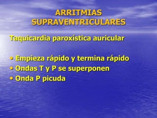 ARRITMIAS
SUPRAVENTRICULARES
Taquicardia paroxística auricular
• Empieza rápido y termina rápido
• Ondas T y P se superponen
• Onda P picuda
 