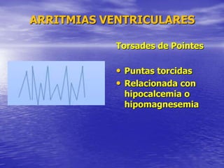 ARRITMIAS VENTRICULARES
Torsades de Pointes
• Puntas torcidas
• Relacionada con
hipocalcemia o
hipomagnesemia
 