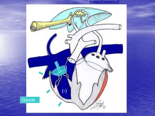 Diástole
(-)
Ismael.anato.cl
 