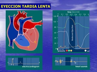 EYECCION TARDIA LENTA
 