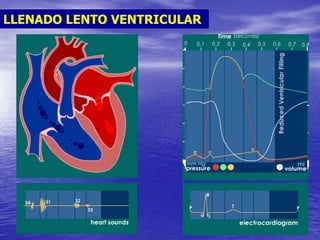 LLENADO LENTO VENTRICULAR
 