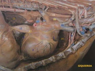 Ismael.anato.cl
2
3
4
5
6
7
8
9
10
11
12
13
1
17
14
15
16
18
IZQUIERDA
 