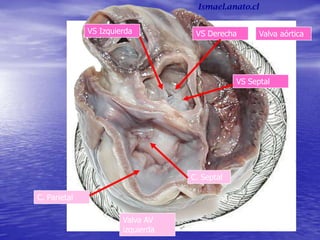 Valva AV
izquierda
C. Parietal
C. Septal
Valva aórticaVS Izquierda
VS Septal
VS Derecha
Ismael.anato.cl
 