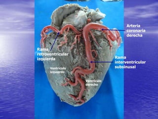 Arteria
coronaria
derecha
Rama
interventricular
subsinusal
Rama
retroventricular
izquierda
Ventrículo
derecho
Ventrículo
izquierdo
 