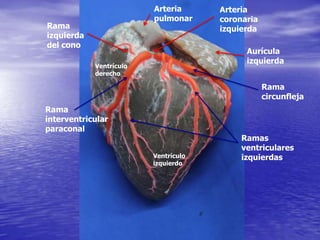 Aurícula
izquierda
Rama
circunfleja
Ramas
ventriculares
izquierdas
Rama
interventricular
paraconal
Ventrículo
derecho
Ventrículo
izquierdo
Arteria
pulmonar
Arteria
coronaria
izquierdaRama
izquierda
del cono
 