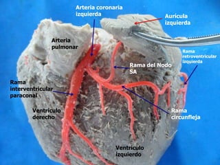 Rama del Nodo
SA
Aurícula
izquierda
Rama
circunfleja
Rama
retroventricular
izquierda
Rama
interventricular
paraconal
Ventrículo
derecho
Ventrículo
izquierdo
Arteria coronaria
izquierda
Arteria
pulmonar
 