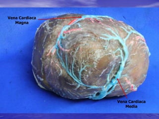 Vena Cardiaca
Magna
Vena Cardiaca
Media
 