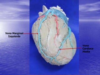 Vena
Cardiaca
Media
Vena Marginal
Izquierda
 