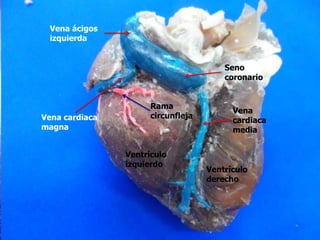 Seno
coronario
Vena
cardiaca
media
Vena ácigos
izquierda
Vena cardiaca
magna
Rama
circunfleja
Ventrículo
izquierdo
Ventrículo
derecho
 