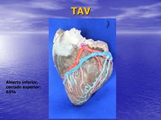 TAV
Abierto inferior,
cerrado superior:
65%
 