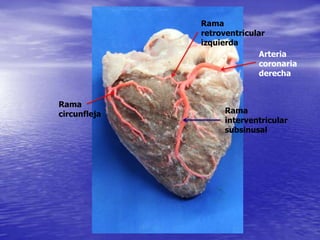 Arteria
coronaria
derecha
Rama
interventricular
subsinusal
Rama
circunfleja
Rama
retroventricular
izquierda
 