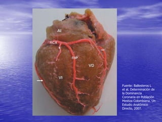 Fuente: Ballesteros L
et al. Determinación de
la Dominancia
Coronaria en Población
Mestiza Colombiana. Un
Estudio Anatómico
Directo, 2007.
 